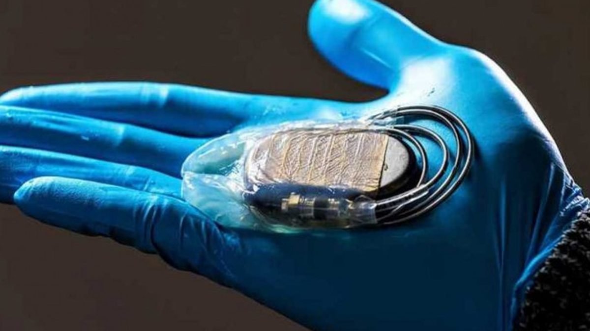 Cardiac Pacemaker Replacement