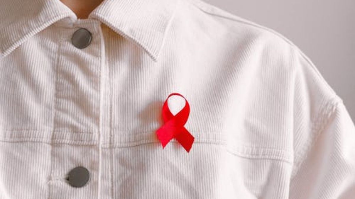 HIV AIDS Representation